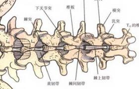 腰椎后路内固定+椎间融合术