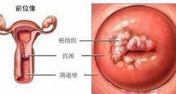 女性患外阴白斑疾病最好吃什么