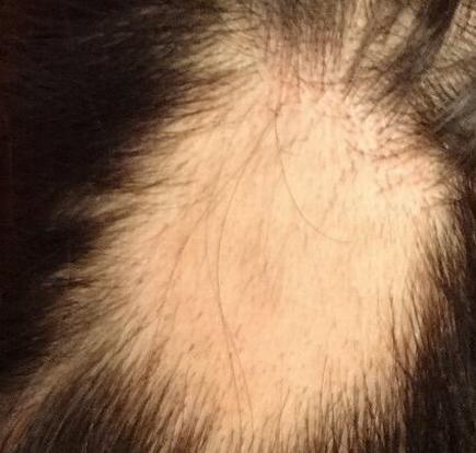 斑秃可遗传 斑秃的治疗小偏方