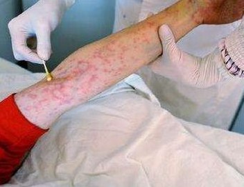 女性性病患者都有什么呢的症状