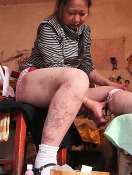 艾滋病防治管理