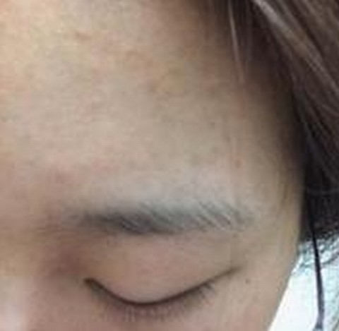 脸上长粉刺是哪些因素