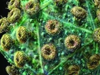 单纯性淋病是什么疾病