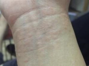 治疗湿疹信赖皮肤病医院