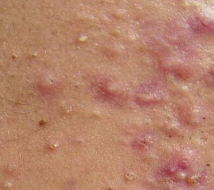 皮肤过敏的病因有什么呢