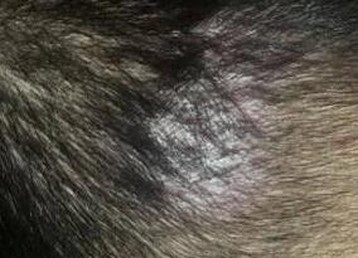 头癣皮肤病具症状有什么特点