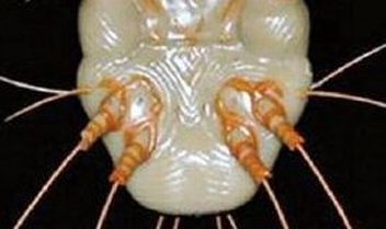 疥疮症状是哪