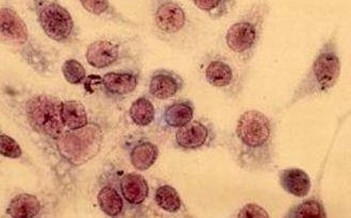 引发 生殖器疱疹的病毒90%是 单纯疱疹病毒Ⅱ型,经过性生活传播是其