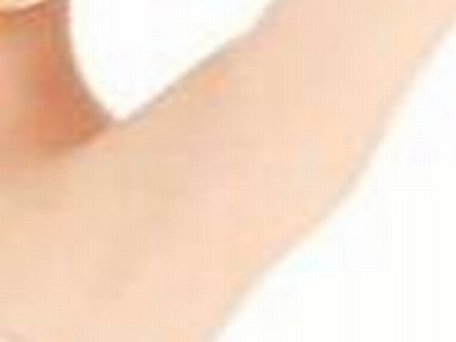 激光是怎样脱毛的 