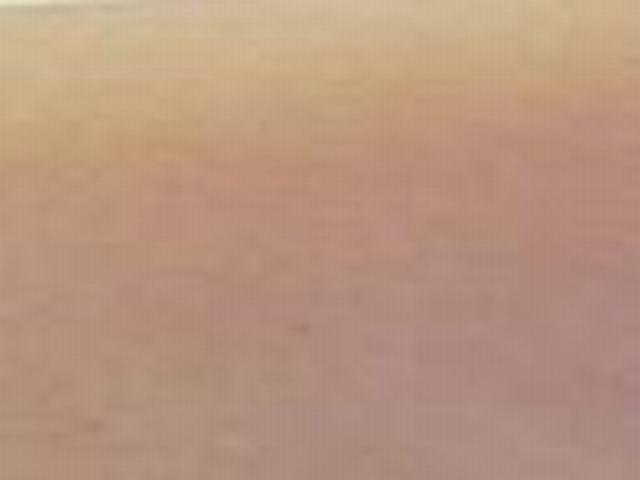 激光脱毛隔多久脱一次好
