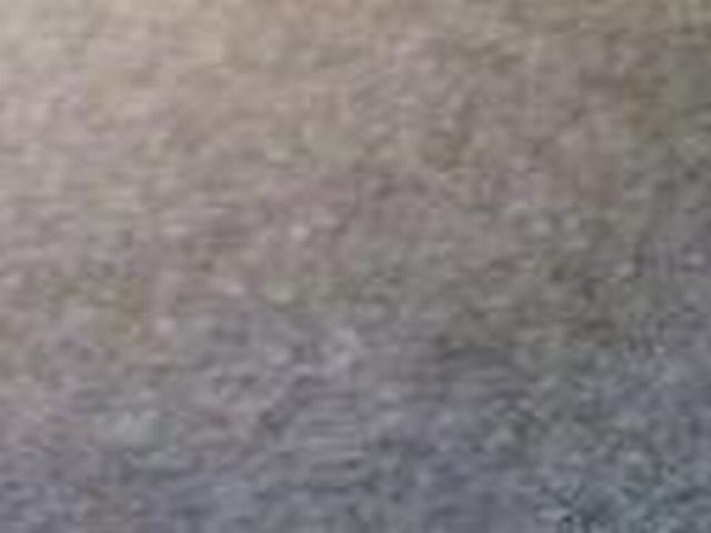 儿童鱼鳞病发病的原因 