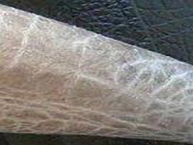 患得鱼鳞病的危害