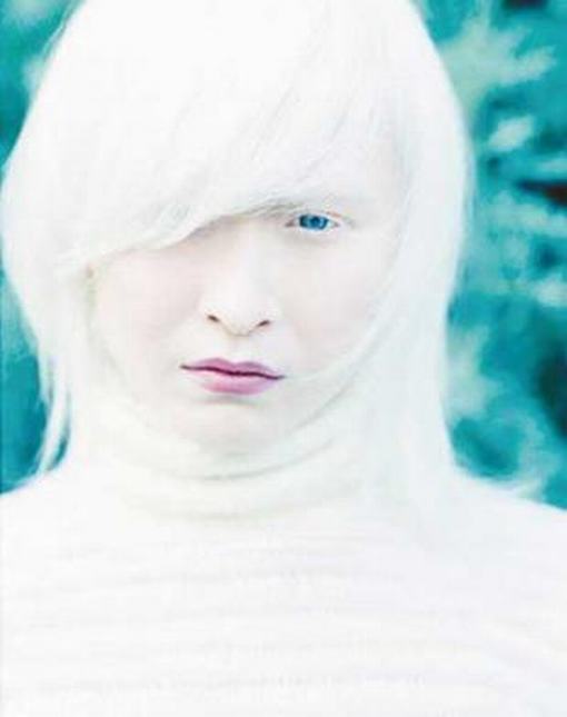 白化病毛发变白有何原因呢