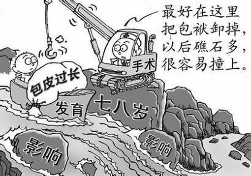 儿童包皮过长不可忽视