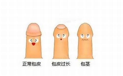 男性包皮过长能自我判断吗