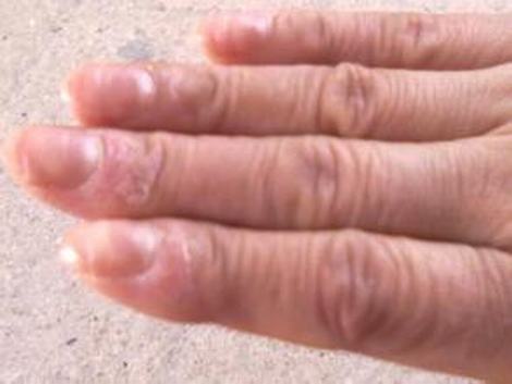 冬日泡澡柚子皮补水治冻疮
