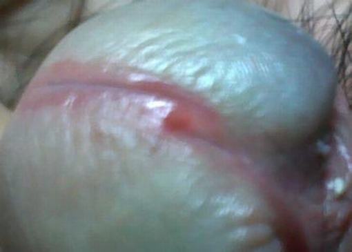可诱发男性尿道炎的病因