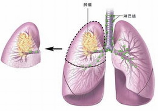 急性皮肌炎有什么表现