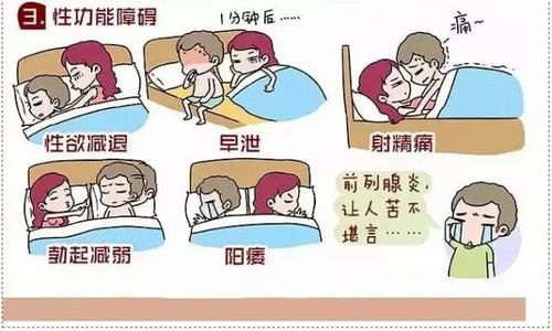 患上前列腺炎会出现什么症状？