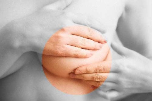 女性乳房湿疹的特征表现