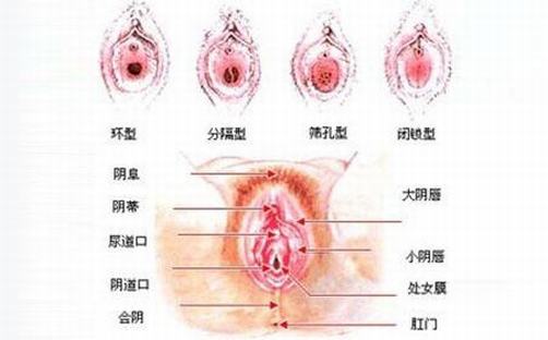 如何防止外阴白斑的发生