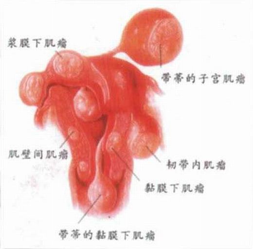 女性要注意外阴白斑的危害有什么？