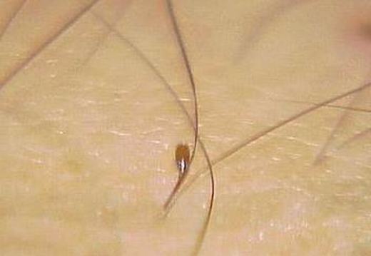 性病不是导致射精不能的诱因