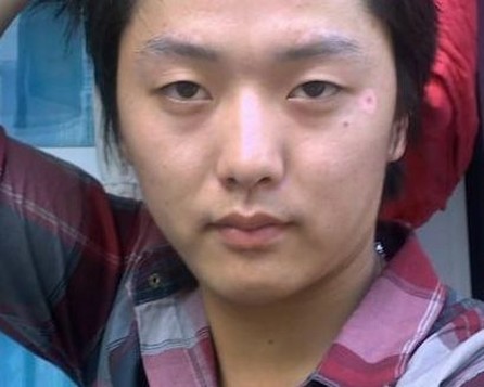 白斑的治疗办法有哪些