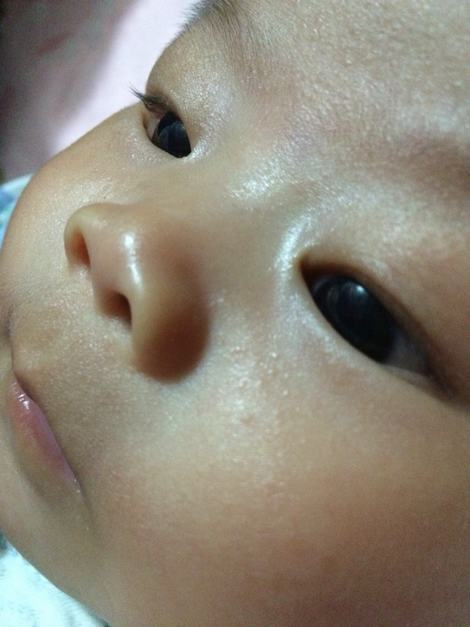 护理婴儿湿疹方法