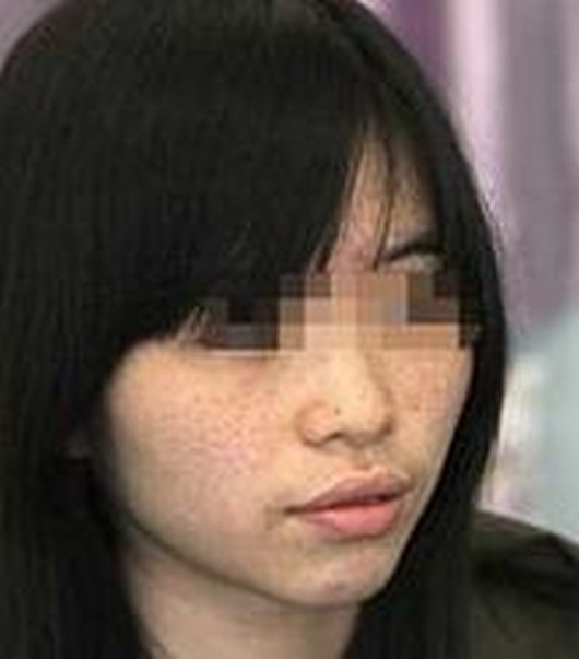 怎样避免雀斑的发生