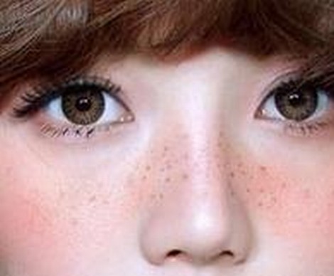哪种方法能够有效的去除面部雀斑