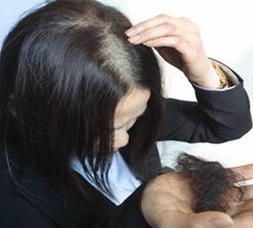 脱发是种常见的皮肤病