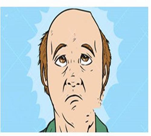 脱发问题该如何解决