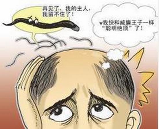 防脱发应该怎么做
