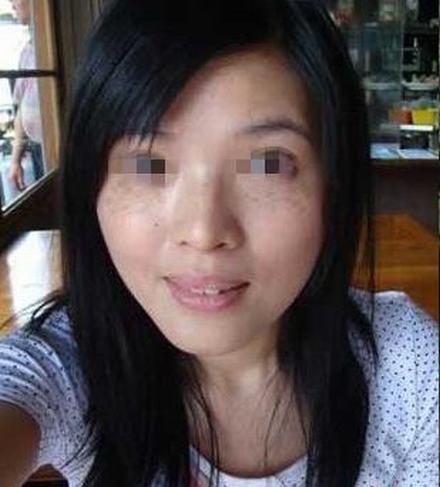 黄褐斑有啥小窍门治愈