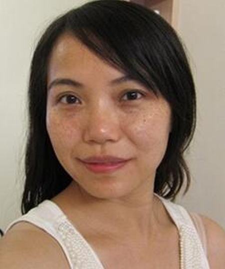 可以治疗黄褐斑的治疗的手法